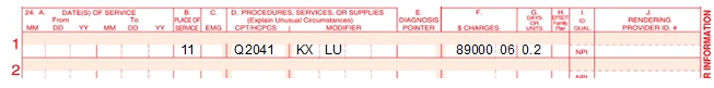 Claim 1 example of CAR T-cell billing. 