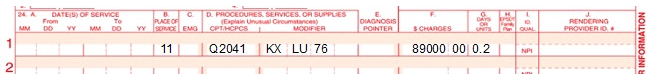 Claim 2 example of CAR T-cell billing. 